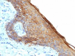 Cytokeratin, HMW Antibody (rKRTH/6617) - Azide and BSA Free, Novus Biologicals 100 &mu;g | Buy Online | Novus Biologicals | Fisher Scientific